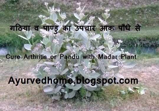 Pandu or Arthritis Diseases Cure with Madar,  गठिया व पाण्डु का उपचार आक पौधे से 