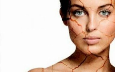 kulit kering kulit kering, dry skin