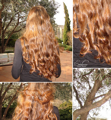 Real trans hair la transplantation des cheveu