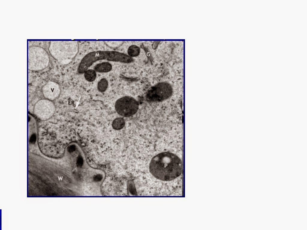 وصغيرة الخلية معدومة الحيوانية في كبيرة هي في تكون النوية. أو النباتية العضية الخلية التي العضية التي