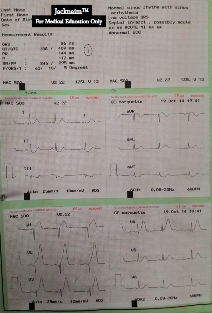 synthroid vs generic levothyroxine synthroid vs generic levothyroxine