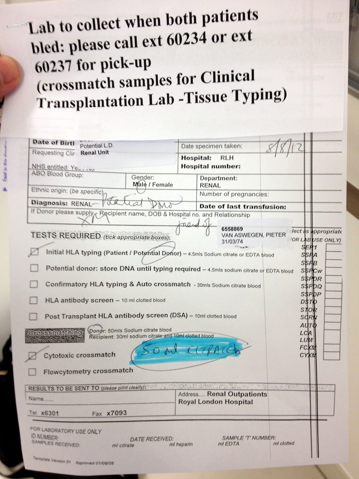 two guys one kidney Tissue and crossmatch tests