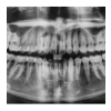 Radiología Oral