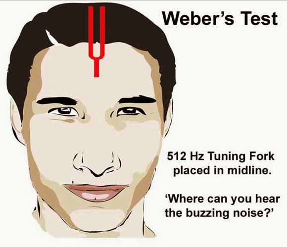 weber tuning fork weber tuning fork