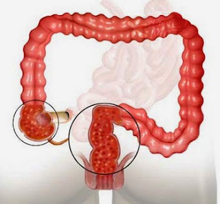 [Image: chua%2Bbenh%2Bviem%2Bdai%2Btrang%2Bbang%...2Bduoc.jpg]