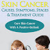 Skin Cancer Causes, Symptoms, Stages & Treatment Guide - Free Kindle Non-Fiction 