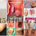 Apotik Herbal Jual Obat Ambeien Non Kimia thumbnail