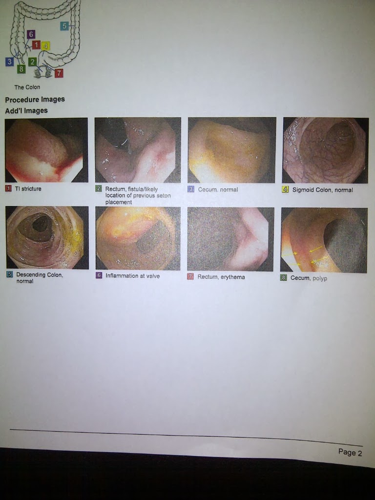 Colonoscopy dissertation 08 picture