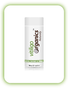 Penawar Penyakit Sopak(Vitiligo) Pengenalan