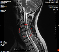 Caffeine & Hot Sauce!: The Blessings of Suffering
