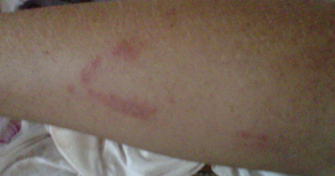 Advice worth 500 sheep Nairobi Eye or Fly is the worst!