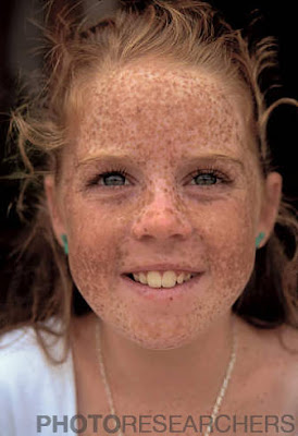Tracing Face Blindness to Its Roots by Karen Barrow NYTimes online