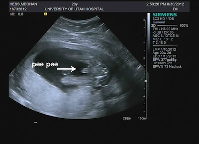 Is That Chocolate or Poop?: It's a Boy!