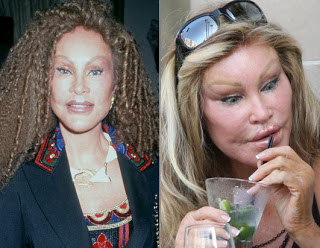 Jocelyn Wildensteins Plastic Surgery The Facts The Myths The Truth - z1qjwd6