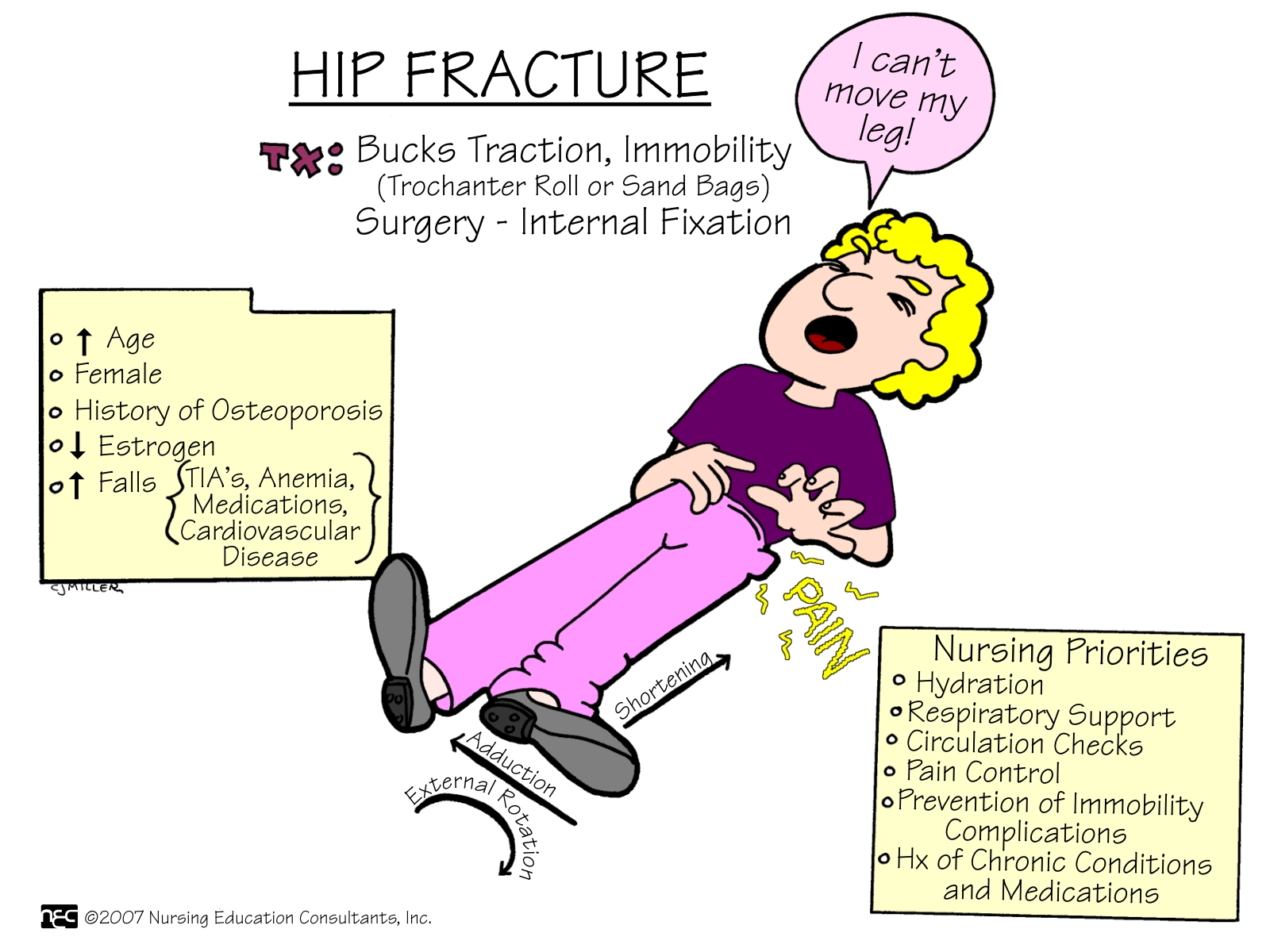 Hip+Fracture.j Hip+Fracture