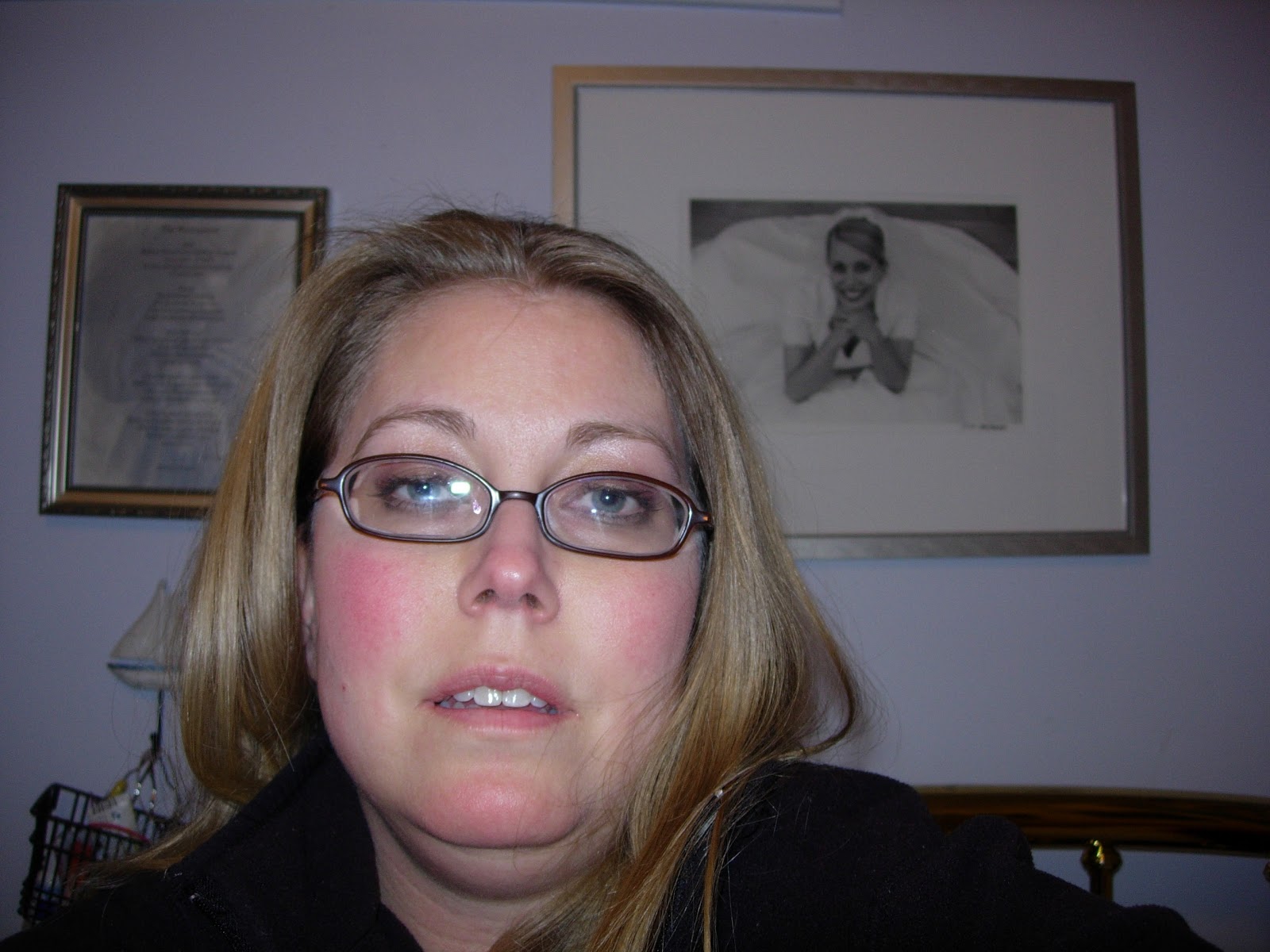 Flop Bott What to Wear on PrednisonePictures of Prednisone Belly and Moon Face