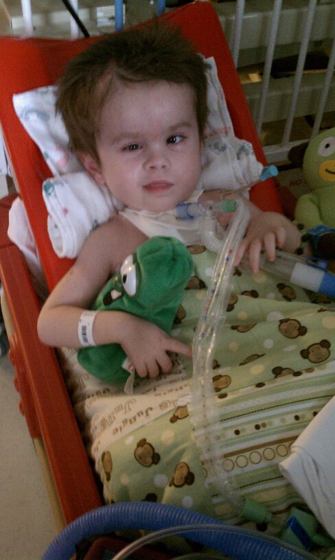 Full Hands Make Full Hearts: Alexander Disease