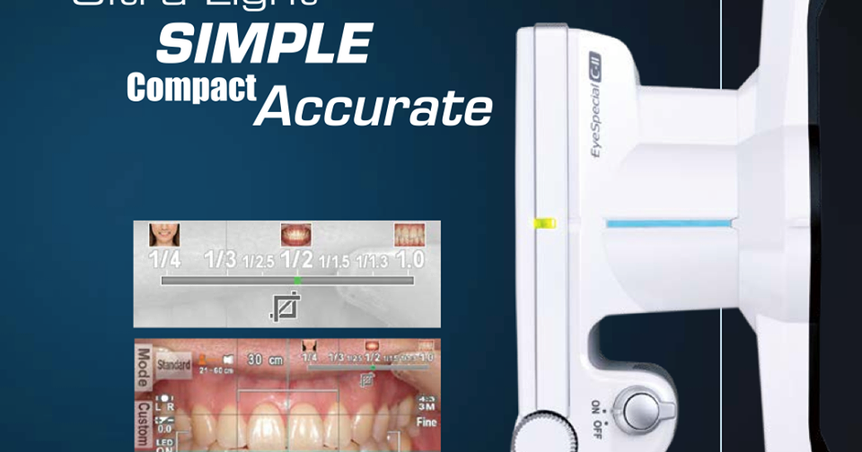 Dental Mart Launching Shofu Japan Eye Special CII Camera MRP 2,50,000/
