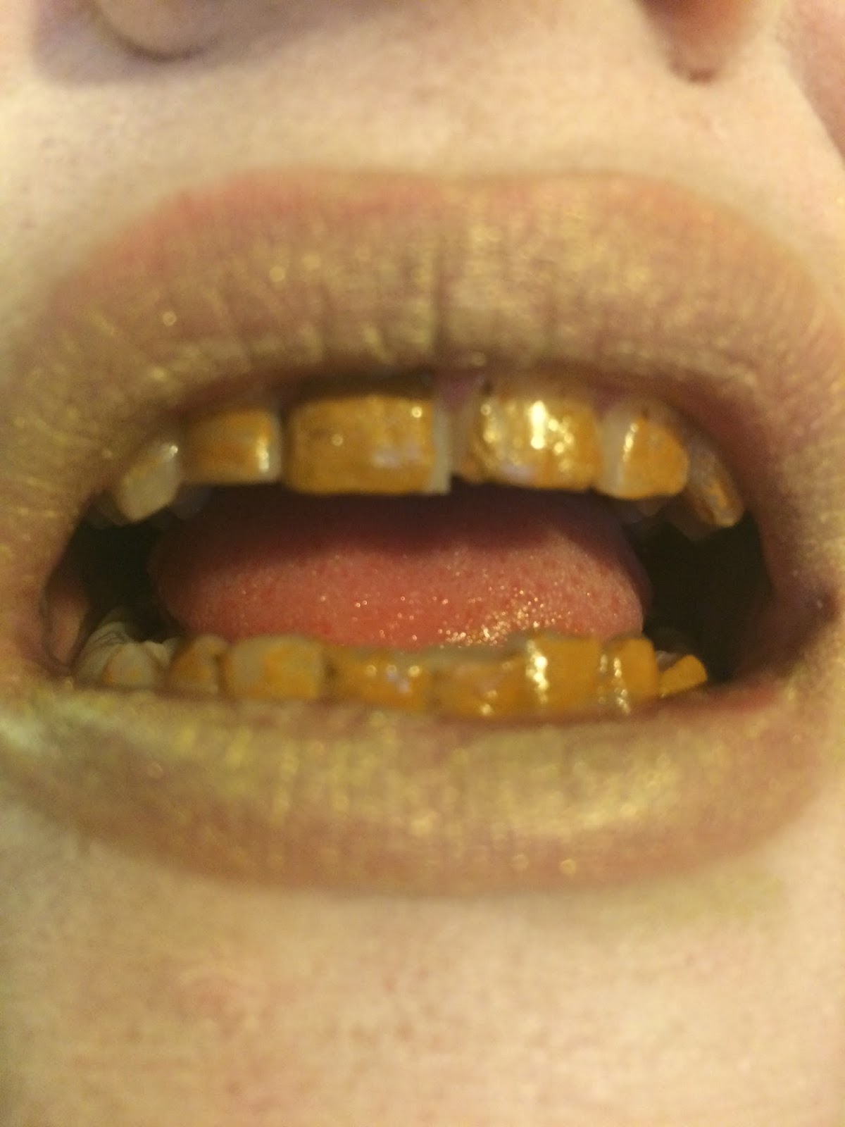 SarahLouise Leftly MUA Dentistry in elizabethan TimeTooth enamal