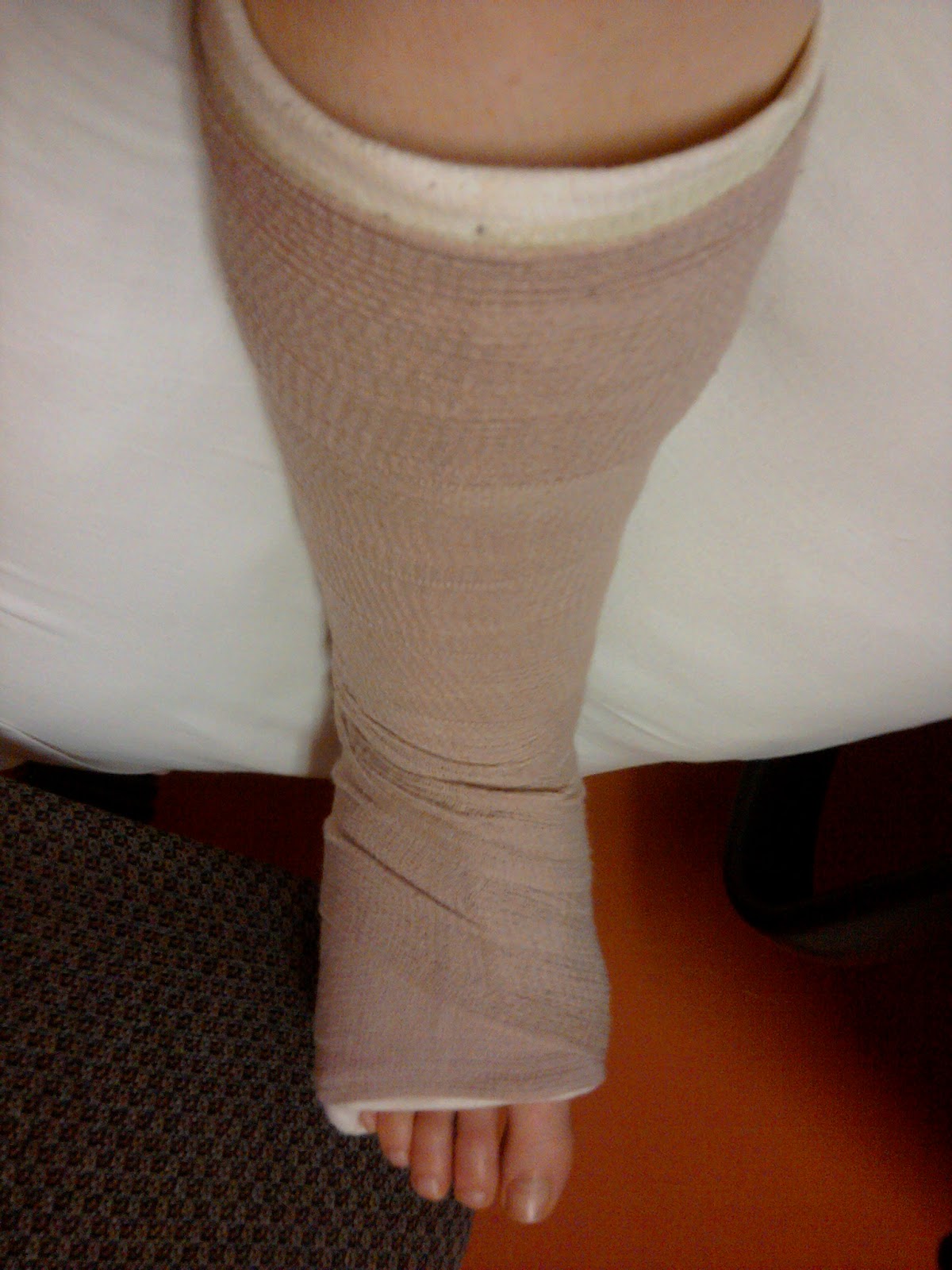 Fractured Metatarsal-3.bp.blogspot.com Broken-in-one-piece
