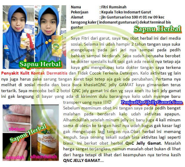Cara Menyembuhkan Dermatitis Di Wajah Terampuh , TERBUKTI Mujarab!! Cara Menyembuhkan Dermatitis Di Wajah Terampuh , TERBUKTI Mujarab!!