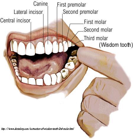 My Wisdom Teeth
