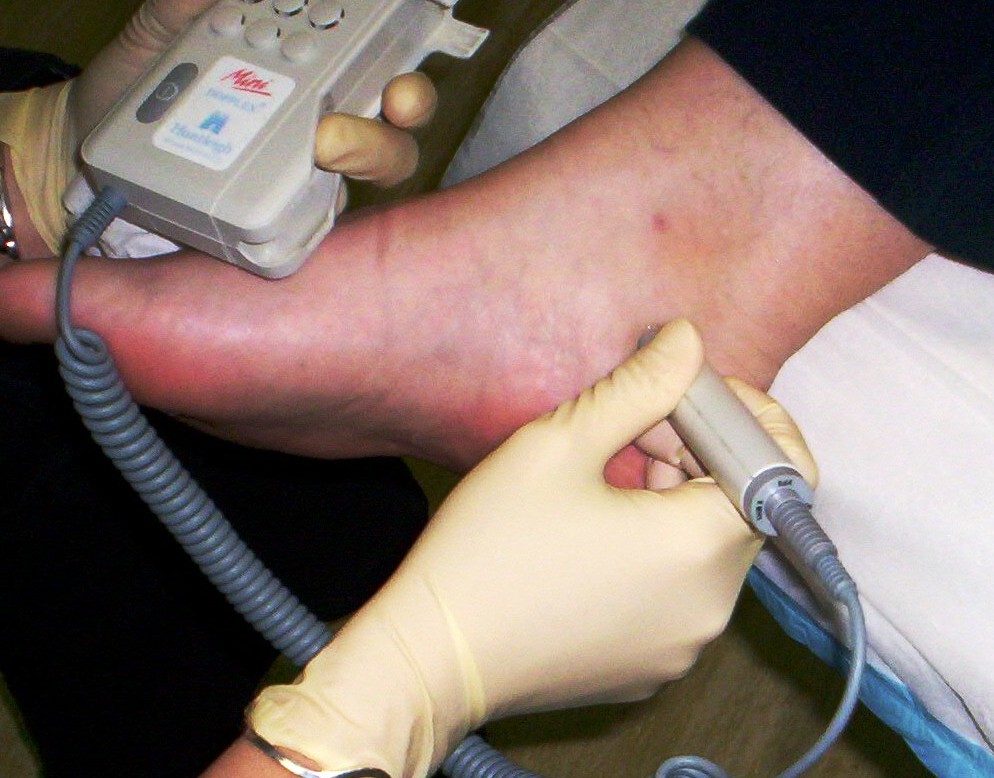 Foot Screening