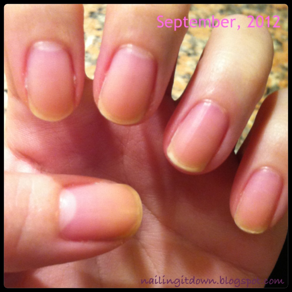 Nailing It Down! Once I HAD Yellow Nails