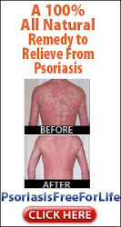 Problems Children Have With Psoriasis