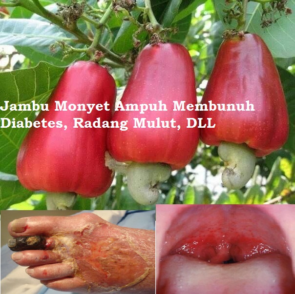Luarbiasa Ternyata Jambu Monyet Mampu Membunuh Diabetes Disentri Dan Radang Mulut Ayo Berbagi