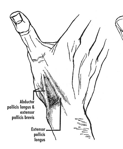 Dr.DV's PGMEE Notes Anatomical Snuff Box