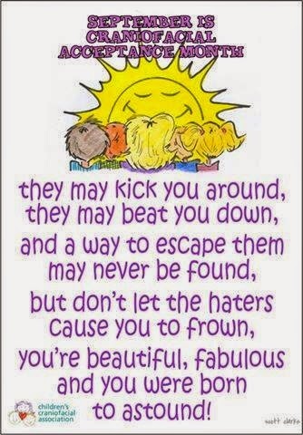 Cca Kids Blog Coming Soon September Is Craniofacial Acceptance