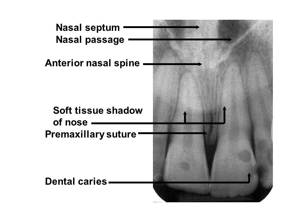 Dentistry Oral Radiology