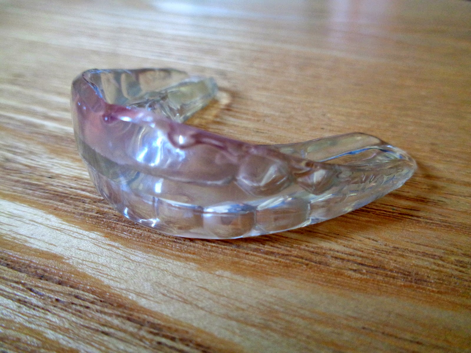 Nourished and Nurtured My Daughter's Orthodontics One Year Update