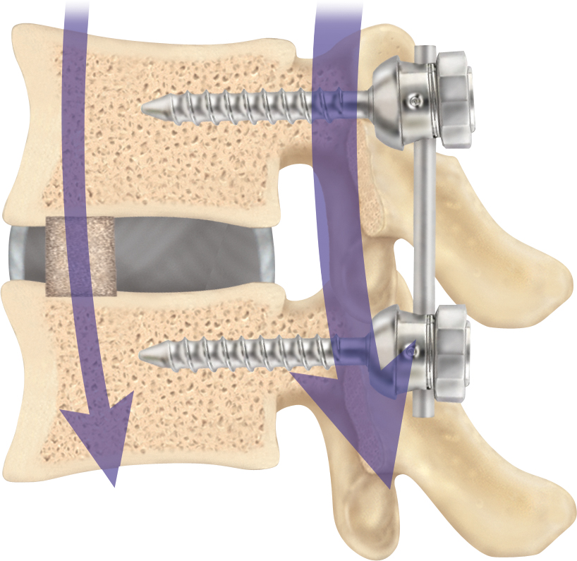 Набор для фиксации ног Concorde Fetish Tentation с маской на глаза, черный 570108 - Concorde - Наборы для фиксации - Купить