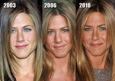 Jennifer Aniston Plastic Surgery on Jennifer Aniston Plastic Surgery Before And After