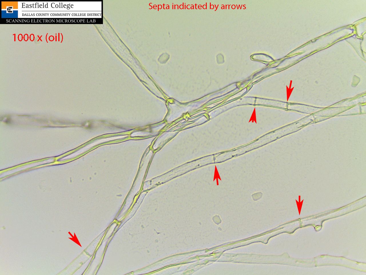 Scanning Electron Microscope Blog A Few More Fungi