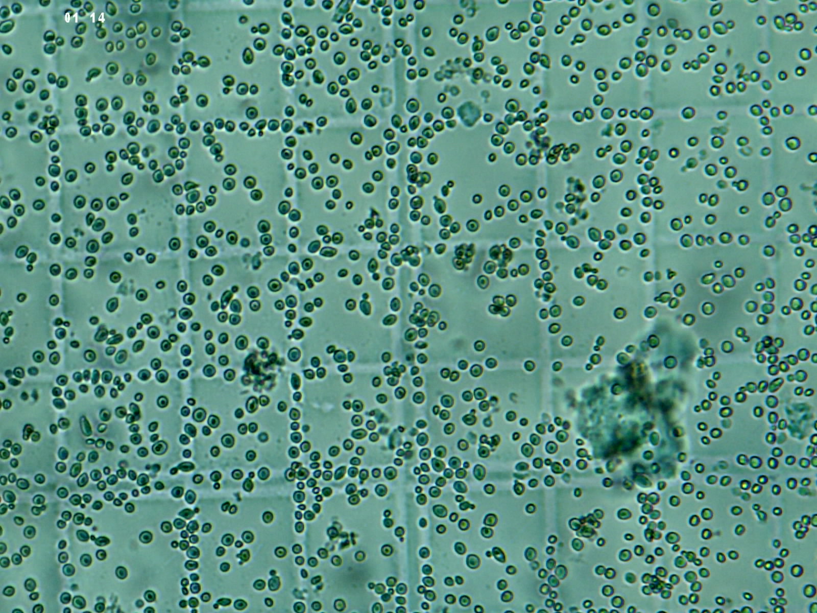 Saccharomyces boulardii The Madhaus