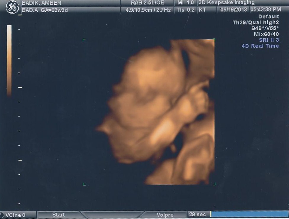 4d ultrasound pictures at 23 weeks 4d ultrasound pictures at 23 weeks