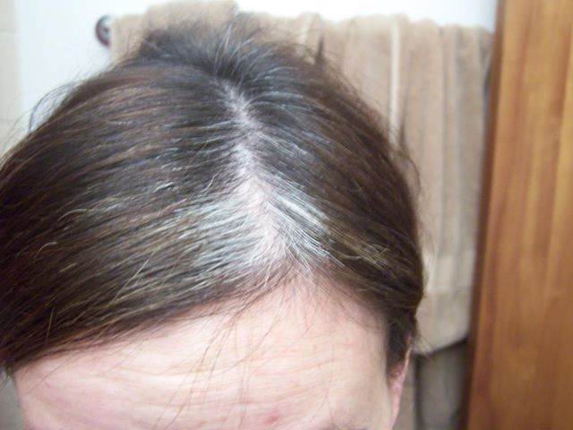 Fashion World Get Rid Of Gray White Hairs