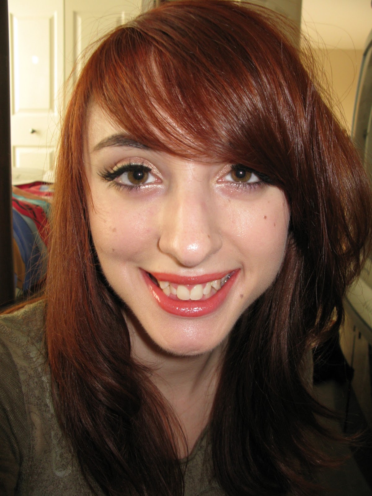 braces got ones recent