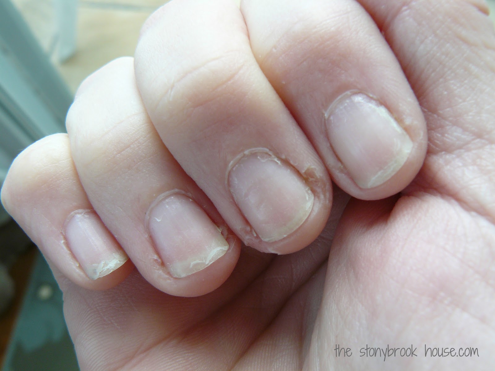 I Am Free & { Manicure Miracle} The Stonybrook House