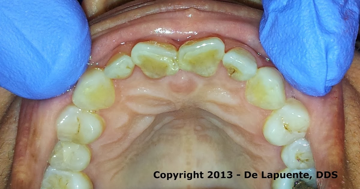 Diagnosing Oral & Maxillofacial Pathologies in My Residency SHOVEL