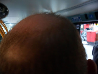 Bald Spot 8