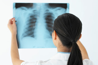 Radiografía tórax, rayos x 