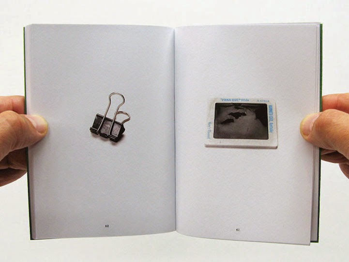 赤ちゃんの口の中から出てきた物の写真集