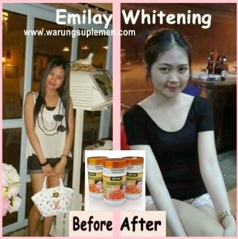Bukti dan Testimoni Emilay whitening Bukti dan Testimoni Emilay whitening