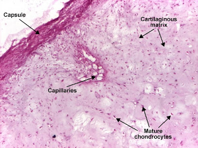 Histology and Explanation of chondroma
