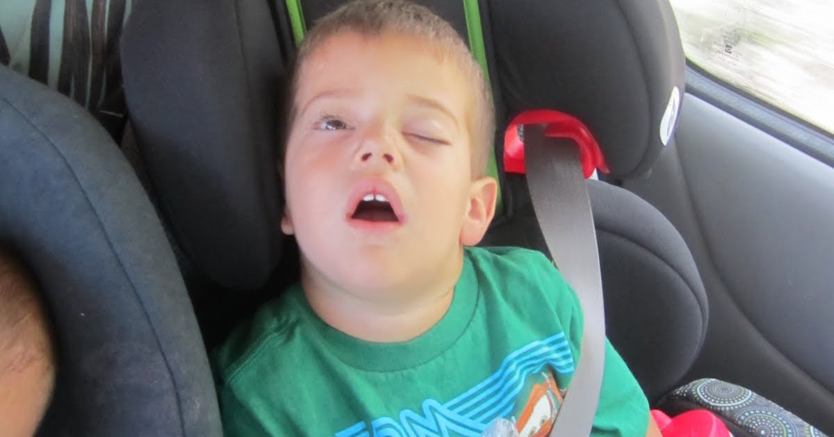 Congential Ptosis and Frontalis Sling Surgery Sleeping Eyes