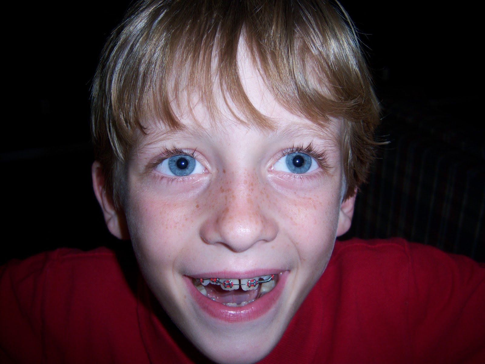 complete debbiness Brace face!